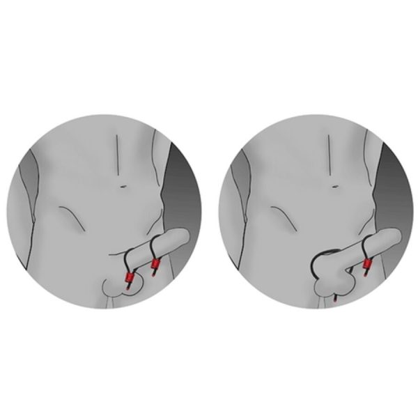 ANÉIS PARA O PÉNIS PRESTIGE COMPATÍVEIS COM ELETROESTIMULADOR (VERMELHO)