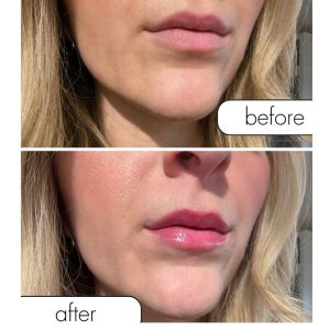 LIP GLOSS COM FEROMONAS PINK PULSE | 8.5 ML - Image 4
