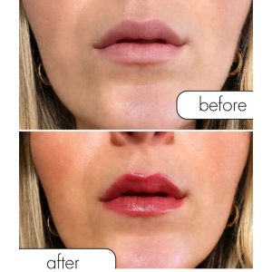 LIP GLOSS COM FEROMONAS CRIMSON KISS (EFEITO VOLUMIZADOR) | 8.5 ML - Image 4